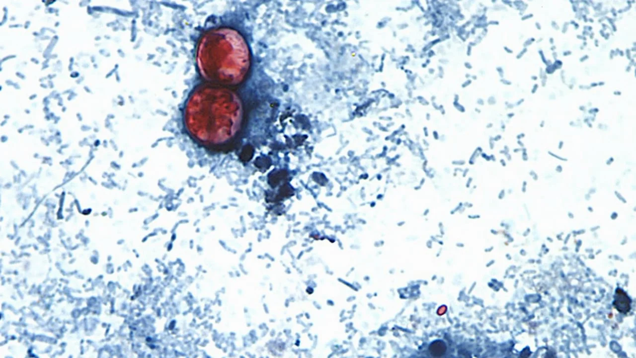 U.S. Authorities Confirm End of Major Cyclospora Outbreak Linked to Lettuce